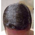 Foto 11