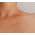 Foto von Clavicula, Ober�sterreich
